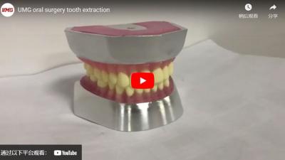 UMG جراحة الفم استخراج الأسنان